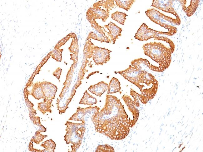 Prostate Specific Antigen (PSA) Antibody in Immunohistochemistry (Paraffin) (IHC (P))