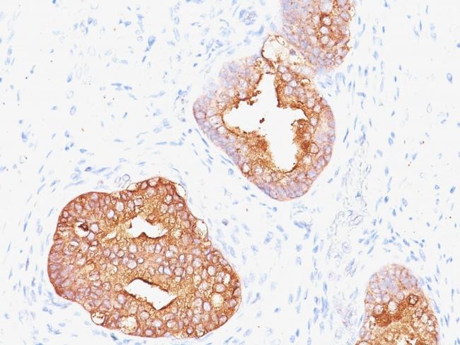 Prostate Specific Antigen (PSA) Antibody in Immunohistochemistry (Paraffin) (IHC (P))