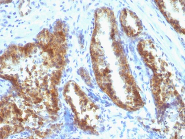 Prostate Specific Antigen (PSA) Antibody in Immunohistochemistry (Paraffin) (IHC (P))