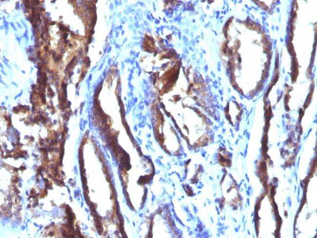 Prostate Specific Antigen (PSA) Antibody in Immunohistochemistry (Paraffin) (IHC (P))