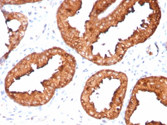 Prostate Specific Antigen (PSA) Antibody in Immunohistochemistry (Paraffin) (IHC (P))