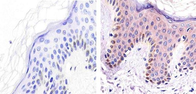 ALK Antibody in Immunohistochemistry (Paraffin) (IHC (P))