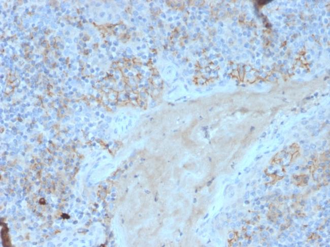 CD95/FAS/TNFRSF6 Antibody in Immunohistochemistry (Paraffin) (IHC (P))