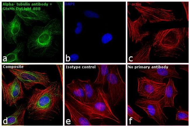 Mouse IgG (H+L) Secondary Antibody in Immunocytochemistry (ICC/IF)