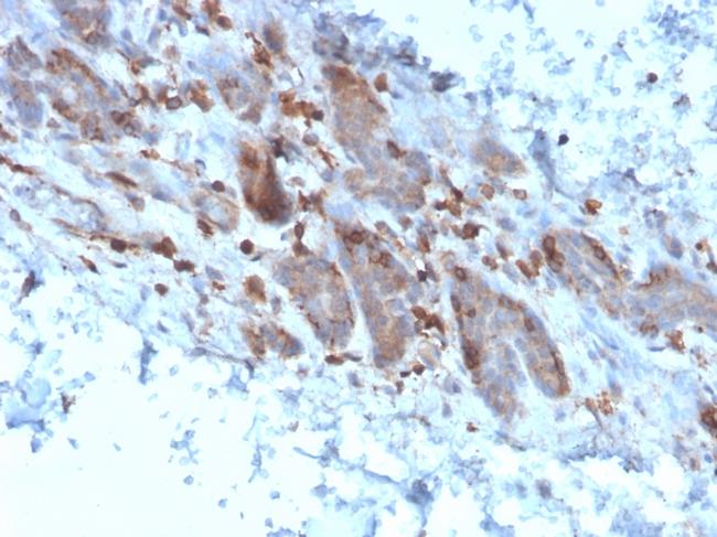 Interleukin-1 alpha (IL-1 alpha) Antibody in Immunohistochemistry (Paraffin) (IHC (P))