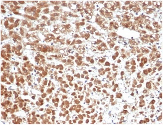 Interleukin-1beta (IL-1beta) Antibody in Immunohistochemistry (Paraffin) (IHC (P))