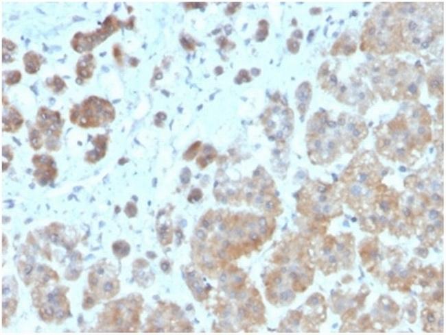 Interleukin-1beta (IL-1beta) Antibody in Immunohistochemistry (Paraffin) (IHC (P))