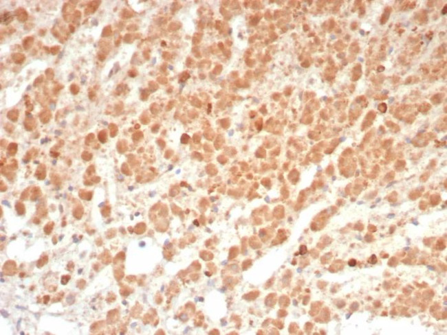 Interleukin-1 beta (IL-1 beta) Antibody in Immunohistochemistry (Paraffin) (IHC (P))