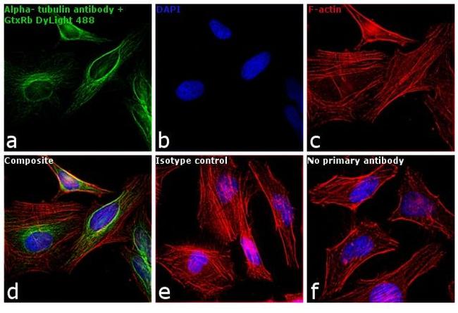 Rabbit IgG (H+L) Cross-Adsorbed Secondary Antibody in Immunocytochemistry (ICC/IF)