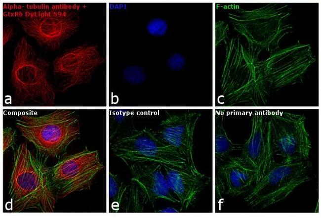 Rabbit IgG (H+L) Cross-Adsorbed Secondary Antibody in Immunocytochemistry (ICC/IF)