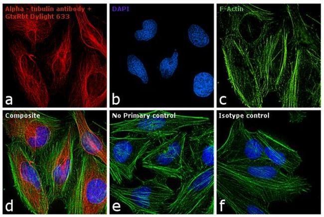 Rabbit IgG (H+L) Secondary Antibody in Immunocytochemistry (ICC/IF)