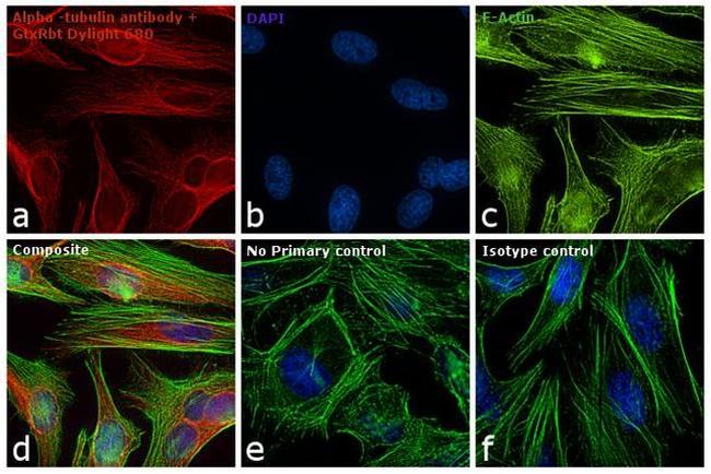 Rabbit IgG (H+L) Secondary Antibody in Immunocytochemistry (ICC/IF)