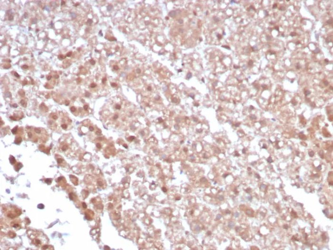 IL1RN/IL-1RN/IL1RA (Interleukin-1RA) Antibody in Immunohistochemistry (Paraffin) (IHC (P))