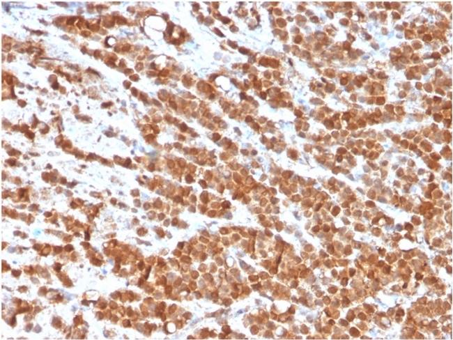 Interleukin-2 (IL-2) Antibody in Immunohistochemistry (Paraffin) (IHC (P))