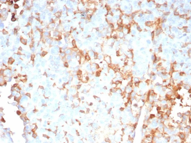 Interleukin-2 (IL-2) Antibody in Immunohistochemistry (Paraffin) (IHC (P))