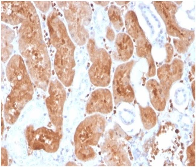 Interleukin-2 (IL-2) Antibody in Immunohistochemistry (Paraffin) (IHC (P))