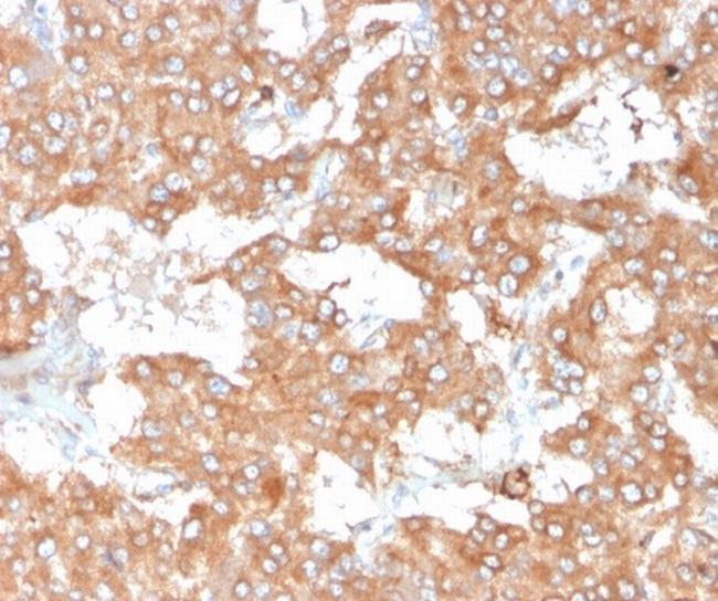 Interleukin-2 (IL-2) Antibody in Immunohistochemistry (Paraffin) (IHC (P))