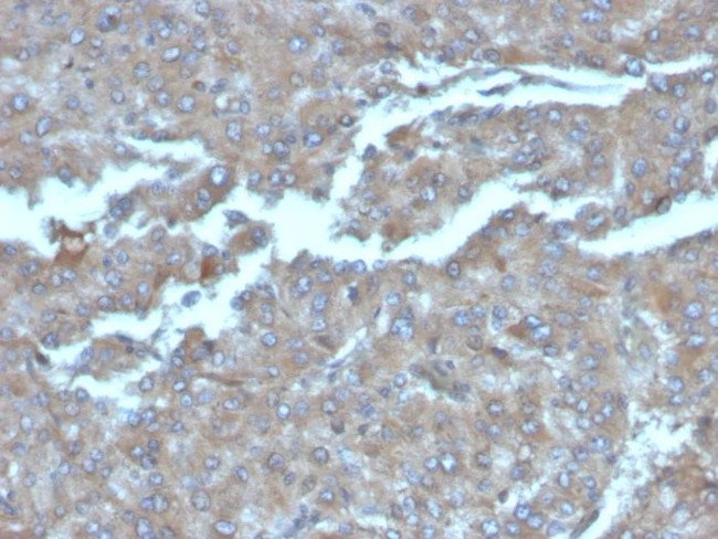 Interleukin-2 (IL-2) Antibody in Immunohistochemistry (Paraffin) (IHC (P))