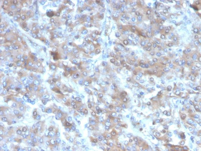 Interleukin-2 (IL-2) Antibody in Immunohistochemistry (Paraffin) (IHC (P))