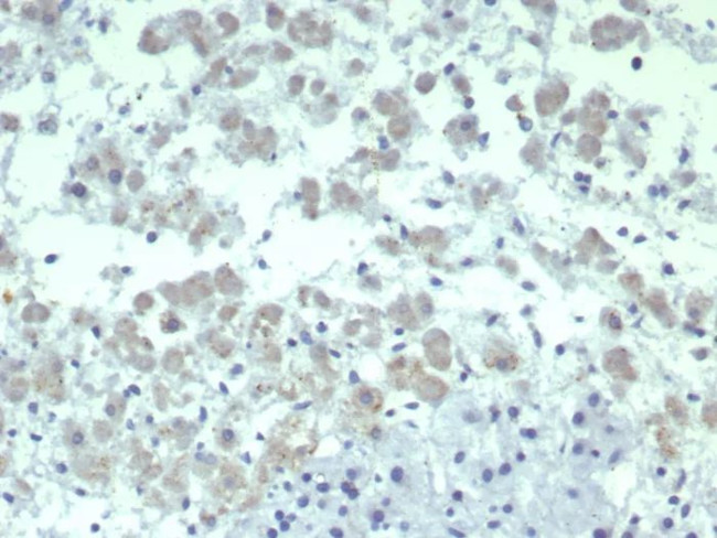 Interleukin-2 (IL-2) Antibody in Immunohistochemistry (Paraffin) (IHC (P))