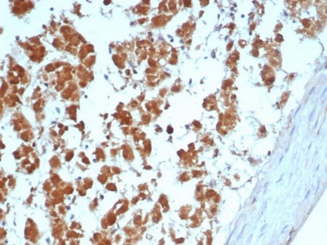 Interleukin-2 (IL-2) Antibody in Immunohistochemistry (Paraffin) (IHC (P))