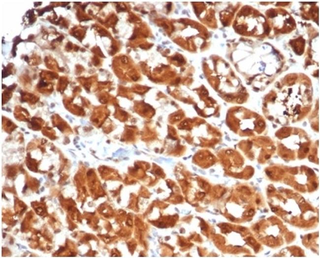 Interleukin-2 (IL-2) Antibody in Immunohistochemistry (Paraffin) (IHC (P))