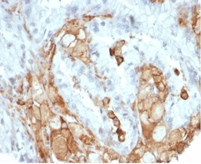 Interleukin-2 (IL-2) Antibody in Immunohistochemistry (Paraffin) (IHC (P))