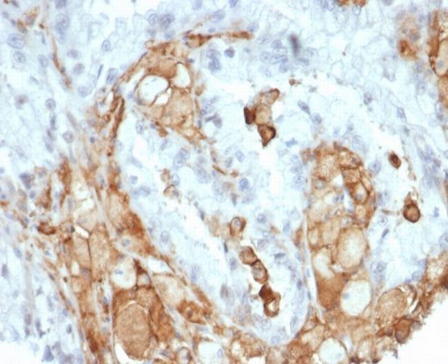 Interleukin-2 (IL-2) Antibody in Immunohistochemistry (Paraffin) (IHC (P))