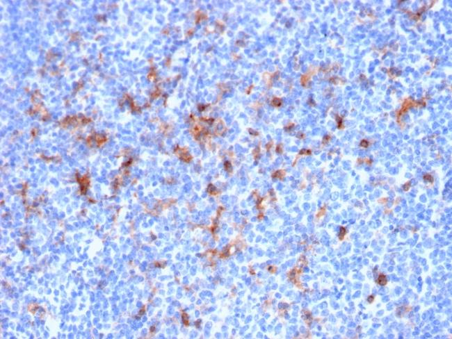 CD25/IL2RA (Activated Lymphocyte Marker) Antibody in Immunohistochemistry (Paraffin) (IHC (P))