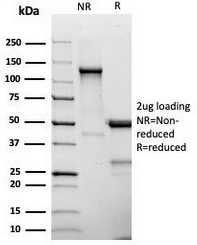 CD25/IL2RA (Activated Lymphocyte Marker) Antibody in SDS-PAGE (SDS-PAGE)