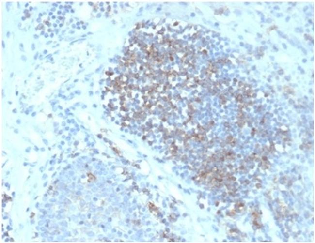 Fas Ligand (FASLG) Antibody in Immunohistochemistry (Paraffin) (IHC (P))