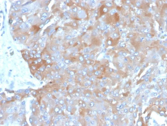 Interleukin-3 (IL-3) Antibody in Immunohistochemistry (Paraffin) (IHC (P))