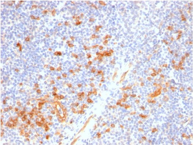 IL3RA/CD123 Antibody in Immunohistochemistry (Paraffin) (IHC (P))