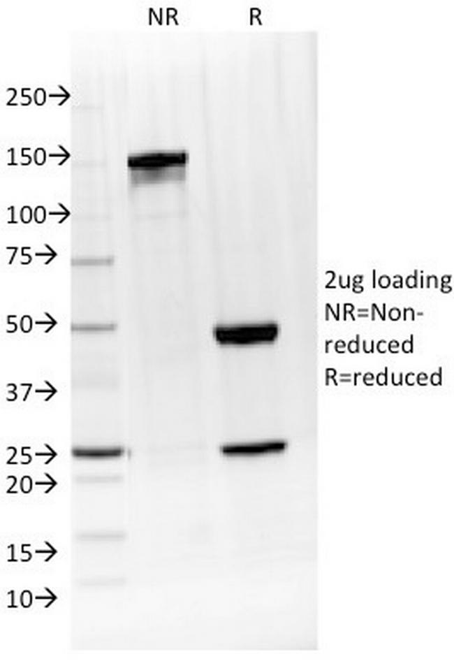 IL-4/Interleukin 4 Antibody in SDS-PAGE (SDS-PAGE)