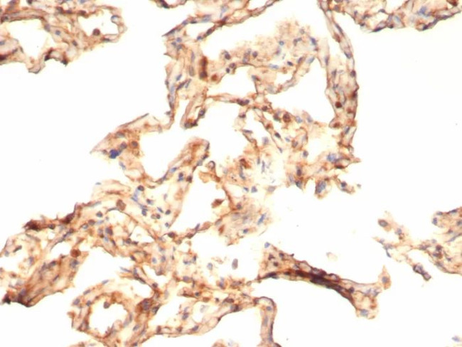 IL-6 (Interleukin-6)/Interferon beta-2 (Hybridoma Growth Factor) Antibody in Immunohistochemistry (Paraffin) (IHC (P))