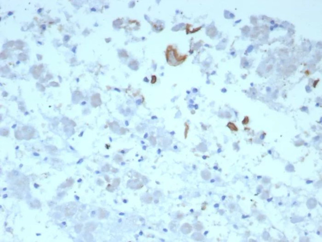 IL-6 (Interleukin-6)/Interferon beta-2 (Hybridoma Growth Factor) Antibody in Immunohistochemistry (Paraffin) (IHC (P))