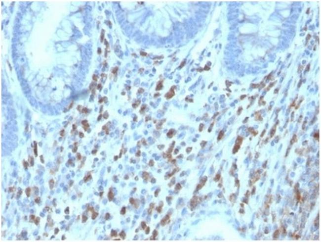 IL6ST/CD130/Interleukin 6 Signal Transducer/IL6RB Antibody in Immunohistochemistry (Paraffin) (IHC (P))