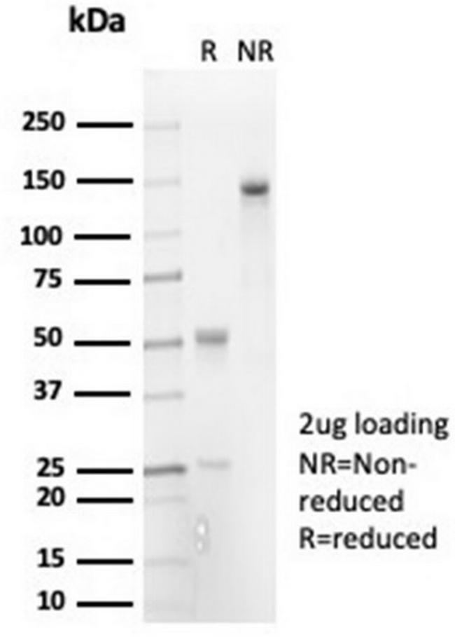 Interleukin-7 (IL-7) Antibody in SDS-PAGE (SDS-PAGE)