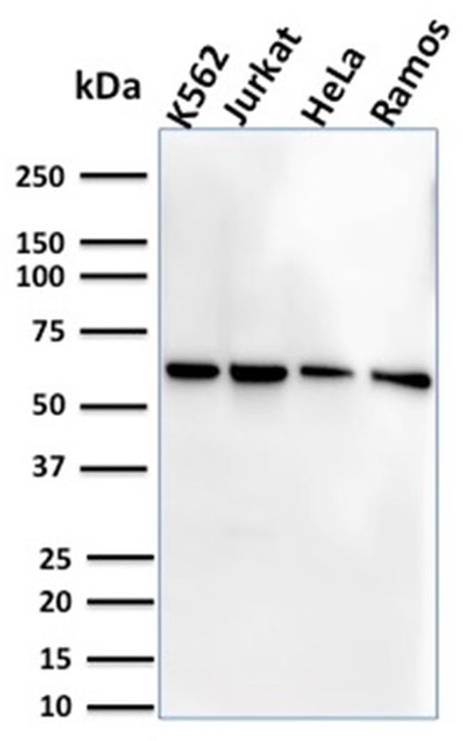 CD127/IL7R Antibody in Western Blot (WB)