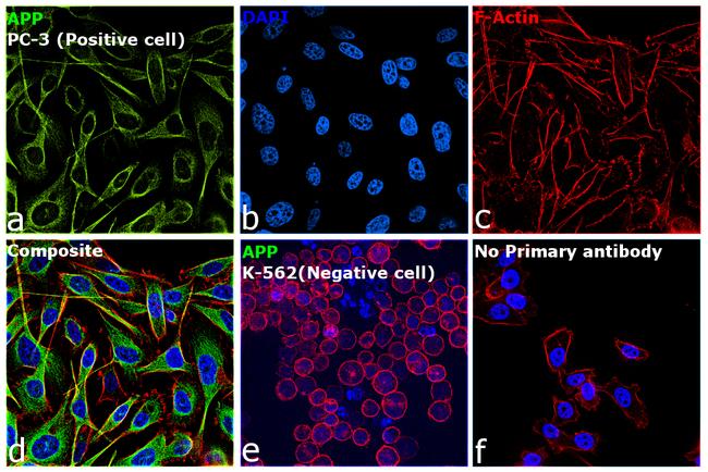 beta Amyloid Antibody in Immunocytochemistry (ICC/IF)