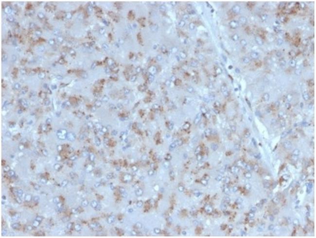 Interleukin-15 (IL-15) Antibody in Immunohistochemistry (Paraffin) (IHC (P))