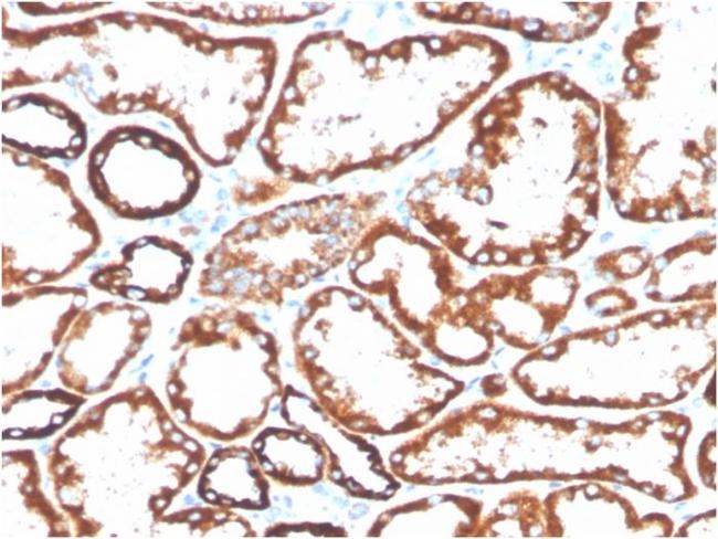 CD137/4-1BB/TNFRSF9 Antibody in Immunohistochemistry (Paraffin) (IHC (P))