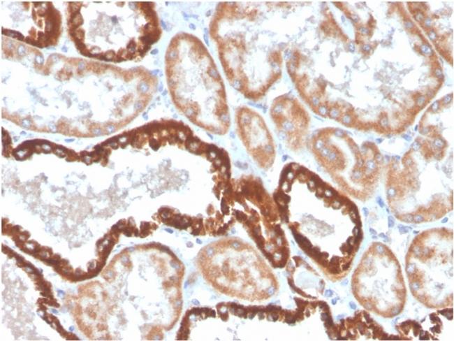 CD137/4-1BB/TNFRSF9 Antibody in Immunohistochemistry (Paraffin) (IHC (P))