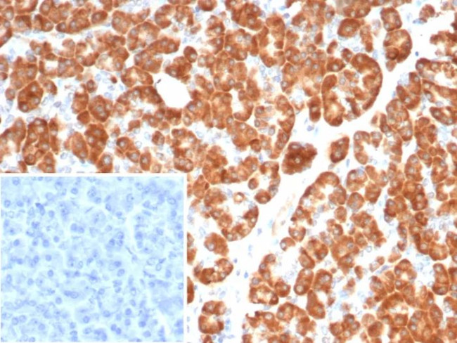 IL-6 (Interleukin-6)/Interferon beta-2 (Hybridoma Growth Factor) Antibody in Immunohistochemistry (Paraffin) (IHC (P))