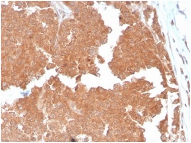 Aquaporin 4 (AQP4) Antibody in Immunohistochemistry (Paraffin) (IHC (P))