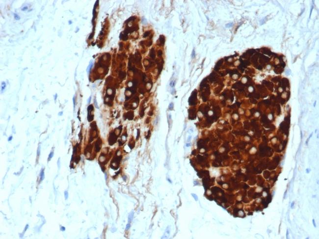 Inhibin, alpha (INHA) Antibody in Immunohistochemistry (Paraffin) (IHC (P))