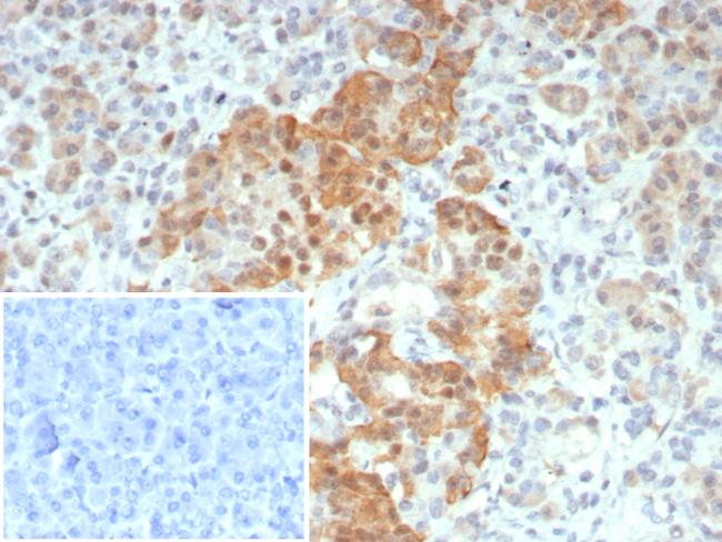 INSM1 (Pan-Neuroendocrine Marker) Antibody in Immunohistochemistry (Paraffin) (IHC (P))