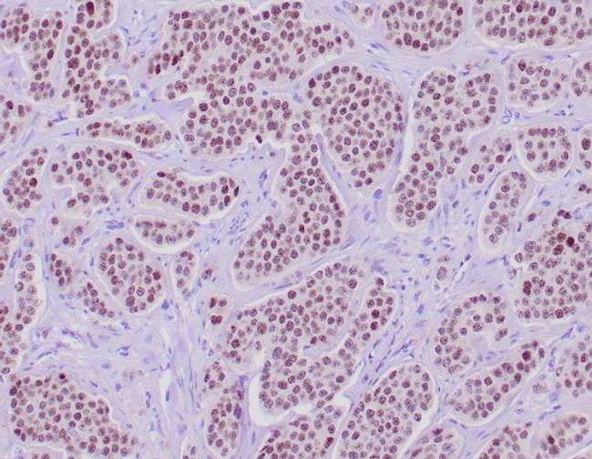 INSM1 (Pan-Neuroendocrine Marker) Antibody in Immunohistochemistry (Paraffin) (IHC (P))