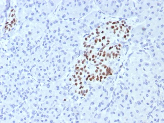 INSM1 (Pan-Neuroendocrine Marker) Antibody in Immunohistochemistry (Paraffin) (IHC (P))