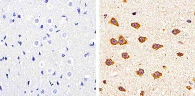 Claudin 11 Antibody in Immunohistochemistry (Paraffin) (IHC (P))